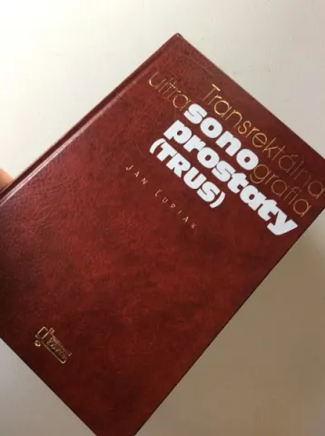 Transrektálna ultra sonografia prostaty (trus) — fotka 2